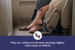 Person sitting in a vehicle with swollen ankles, accompanied by text about ankle swelling during flights and long car rides.