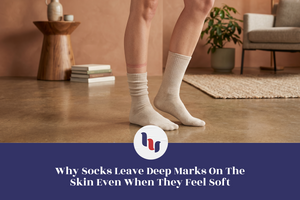 Person wearing soft beige crew socks with visible sock marks on the leg, illustrating pressure lines and circulation discomfort from tight socks