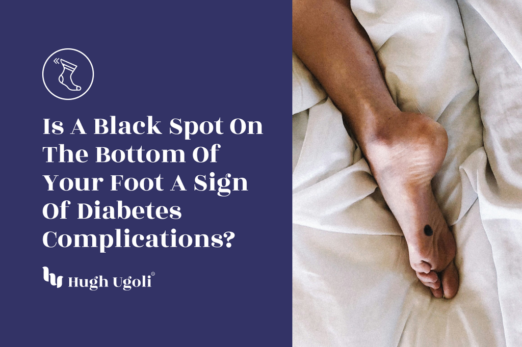 Close-up of a person's foot lying on a bed, showing a black spot on the sole, with a text overlay asking if it could be a sign of diabetes complications.