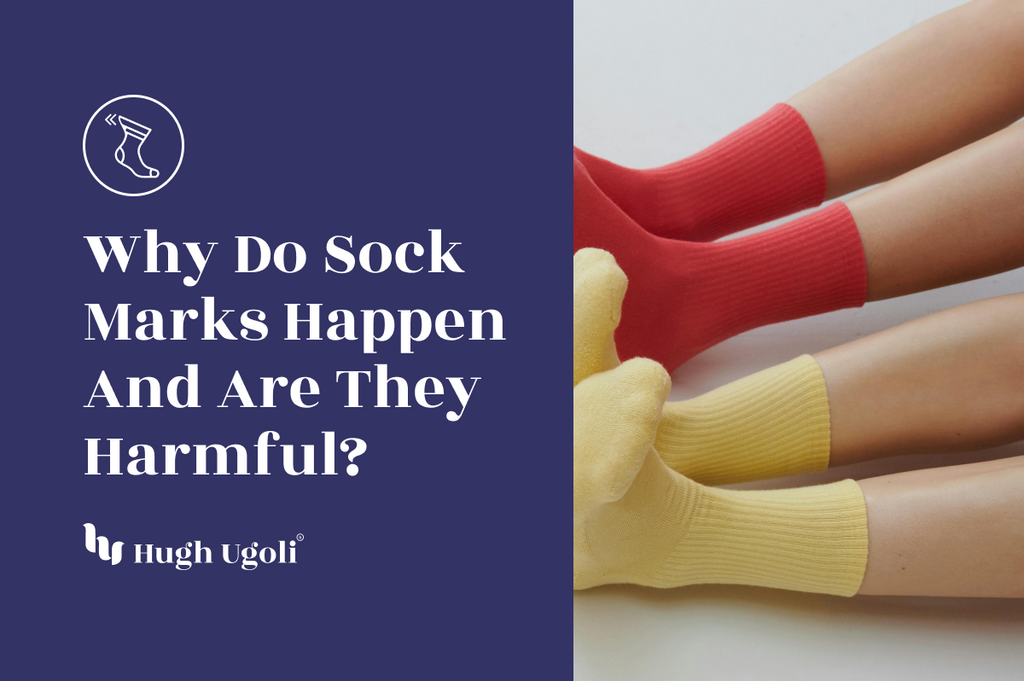 Three pairs of legs with colorful socks (red and yellow) lying side by side, focusing on the marks left by the socks on the skin, highlighting the topic of sock marks.